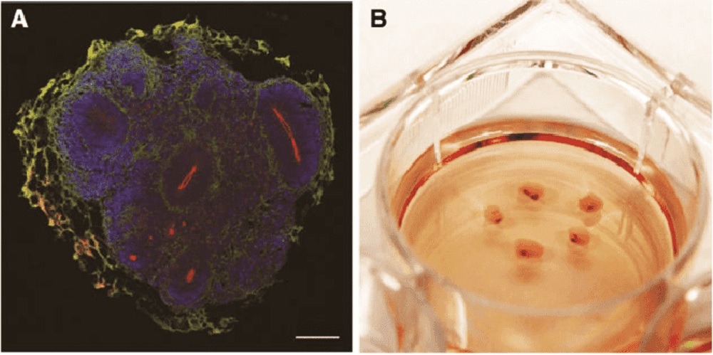 Organoids